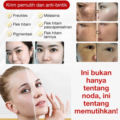 Esensi pencerah spot