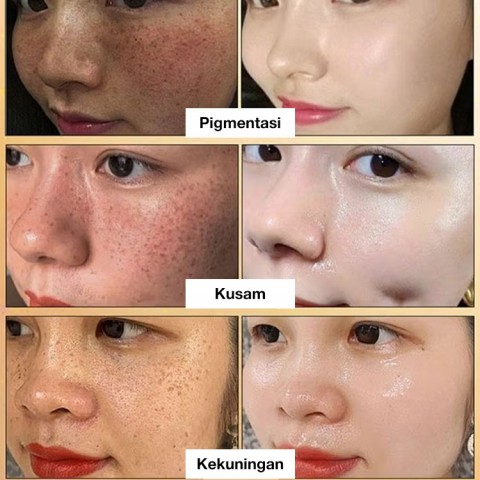 Esensi pencerah spot