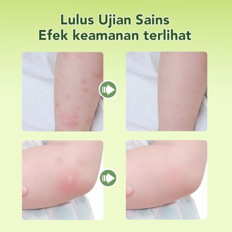 Balsem Anti-gatal Bayi