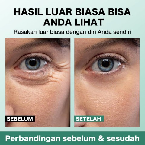 Krim Esensi Mata