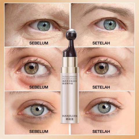 Serum mata anti-kerut polipeptida adas laut