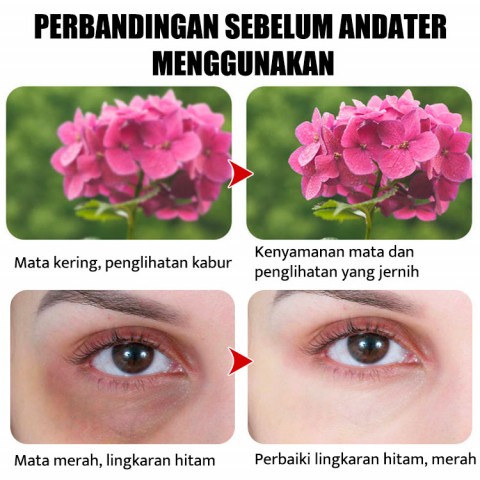 Blueberry Lutein Eye Patch-Meringankan Kelelahan dan Kekeringan Mata