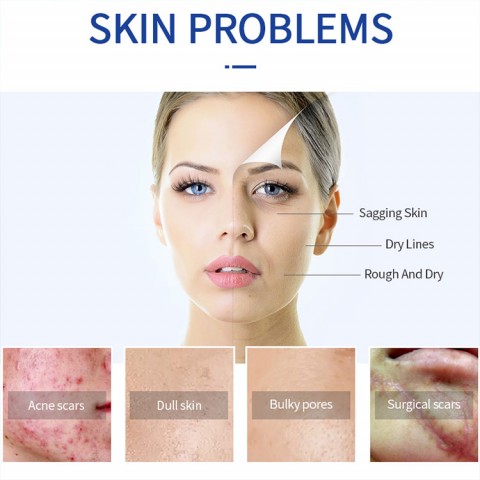 Shark Scar Repair Cream