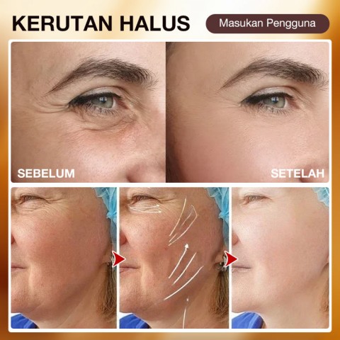 Krim Anti-Kerutan Kolagen Emas