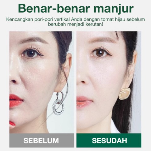 Ampul pengangkat pori-pori tomat hijau