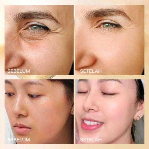 Esensi Kapsul Ceramide Ruang-waktu