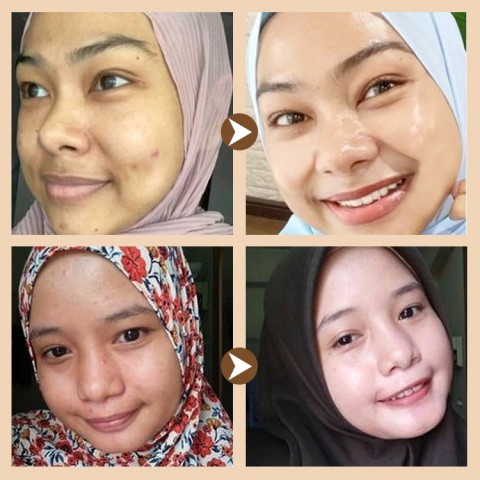 krim concealer pelembab