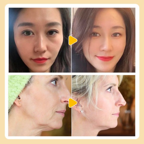 Masker Kulit Telur Ragi