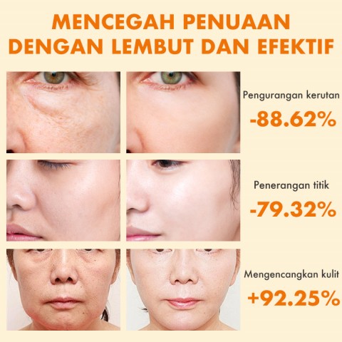 Ellen Ella Serum Retinol yang Ditingkatkan