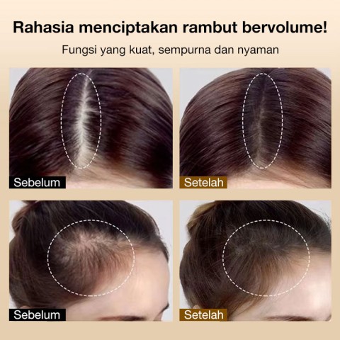 Bedak Garis Rambut