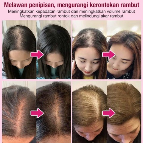 Hair spray