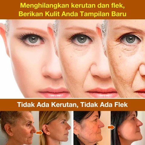 Cordyceps sinensis dan serum anti kerut Pro-Xylane