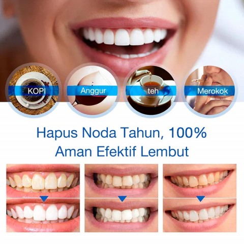 Esensi Pemutih Gigi