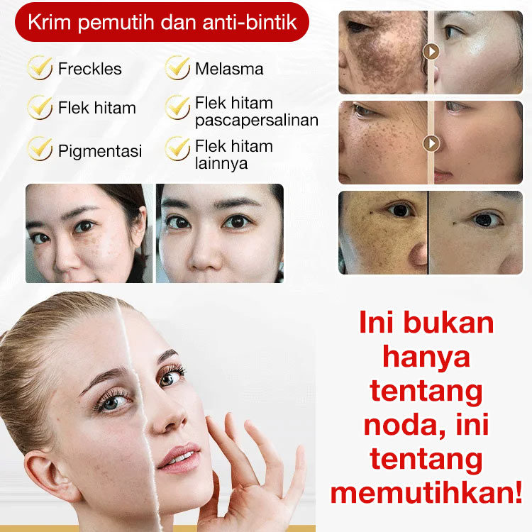 Promo Besar 7.7-Potongan kedua hanya 70 rb - Esensi pencerah spot - Ucapkan selamat tinggal pada semua bintik-bintik, bintik hitam, dan bintik matahari!	
