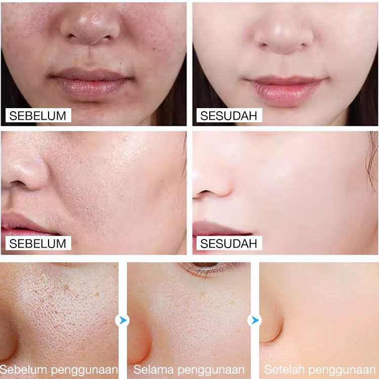 Promo Besar 7.7- beli satu gratis satu - Gel Pengelupas Enzim Pemurni-Saatnya mengucapkan selamat tinggal pada kulit kusam! Ucapkan Selamat Datang pada Kulit Halus dan Bercahaya!