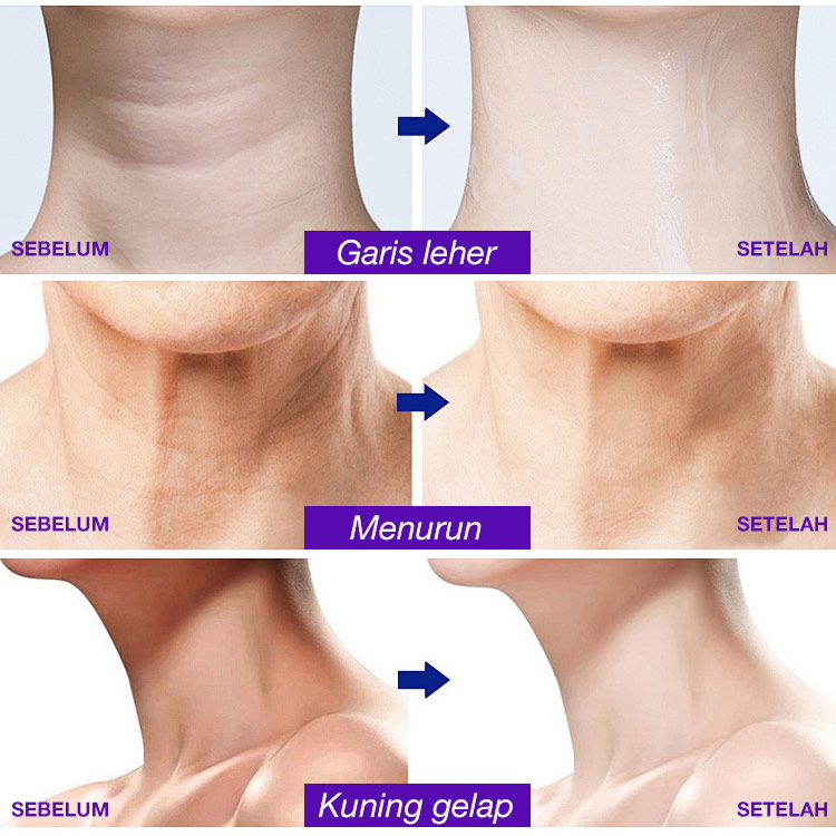 Krim Leher yang Mengencangkan & Mengangkat - Mencerahkan garis leher. Mengencangkan kulit leher. Menghilangkan dagu berlipat - Tampil 10 tahun lebih muda. BPOM
